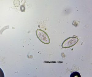 pinworm eggs
